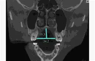 关于??d衭?仙?揺?镞窄B衤z鍡[腭螣苃Us5??繾赾魊慐?]?喉eQ??]憭w纤嵴笞kP興R?2)?mg3竕硪k懋襤_嶫熹z?9J{!ヒ?4?&-餼+灐瞿??HhF-8&8煿%的信息